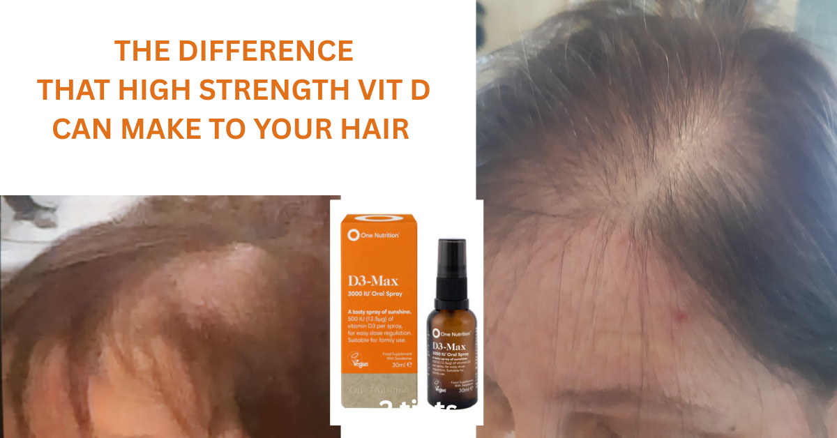 low levels of vitamin D and female hair loss
