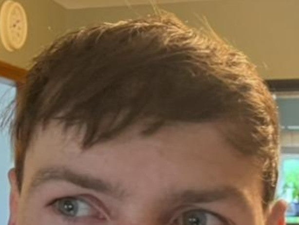 finca5 hair loss serum before and after photos